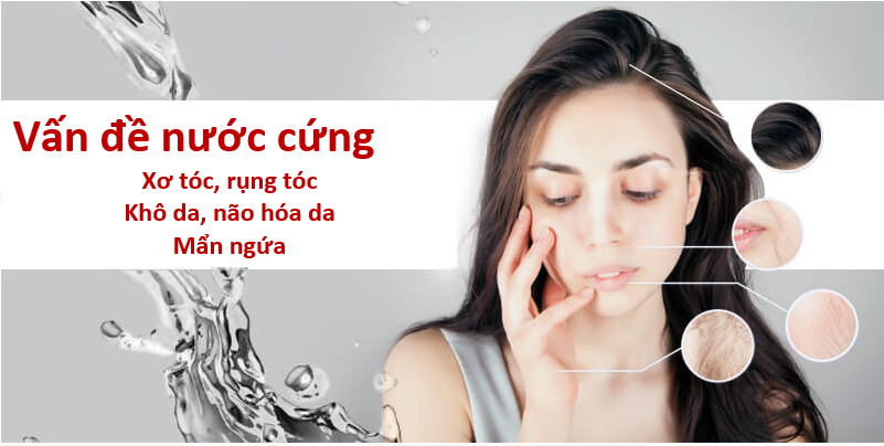 Nước đá vôi (nước cứng) gây nhiều ảnh hưởng tiêu cực tới da và tóc của bạn 